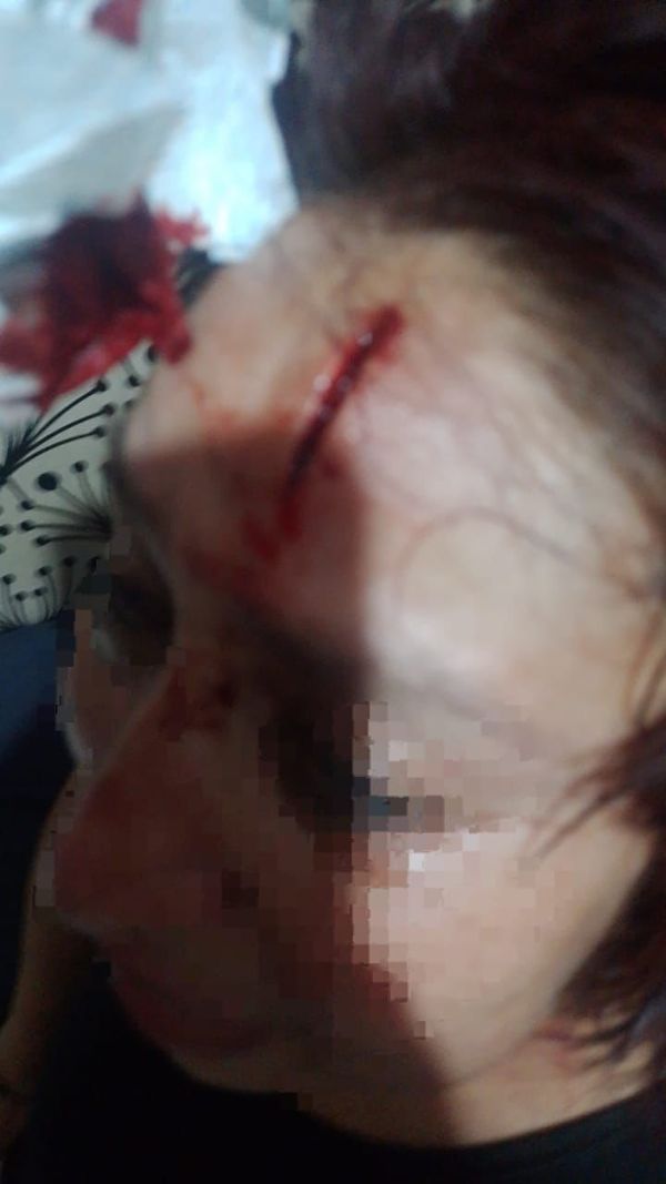 Mujer es agredida a machetazos