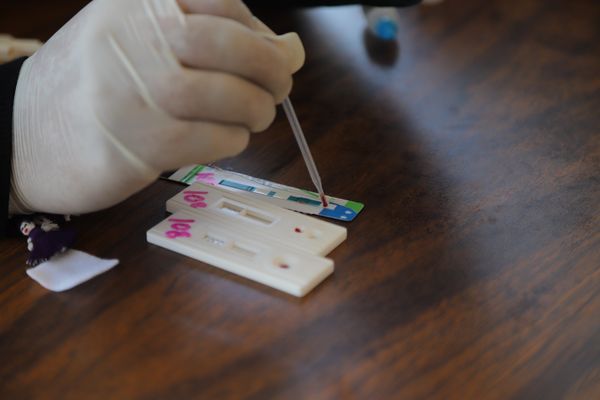 SSM realiza pruebas rápidas de VIH en 364 centros de salud