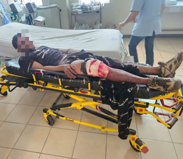 Asegura GC a venezolano herido en enfrentamiento